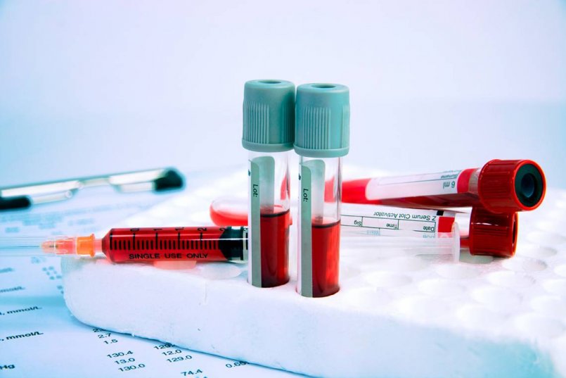 Сдать анализ крови на гормоны в красноярске thumbnail